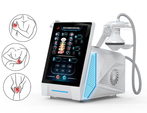 Bild von Focus Shockwave – Stoßwellentherapie